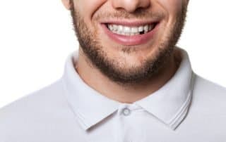 missing teeth