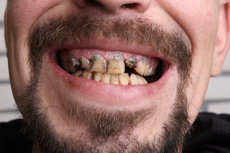 signs of oral cancer signs of oral cancer