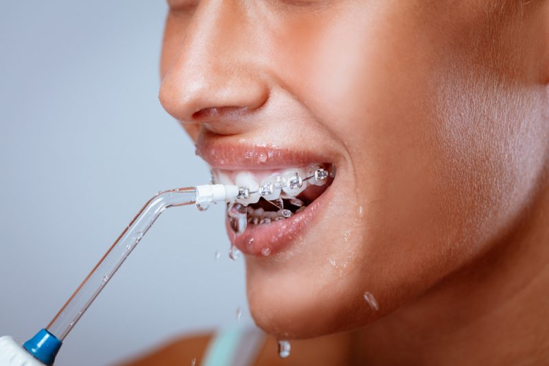 water flosser water flosser