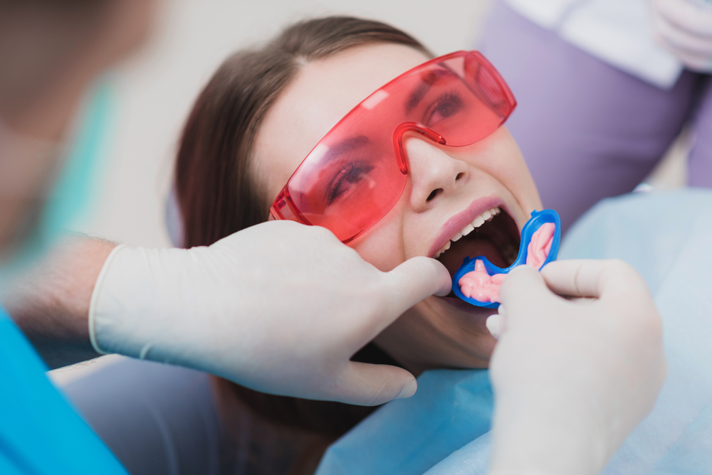 fluoride treatment in keller tx fluoride treatment in keller tx