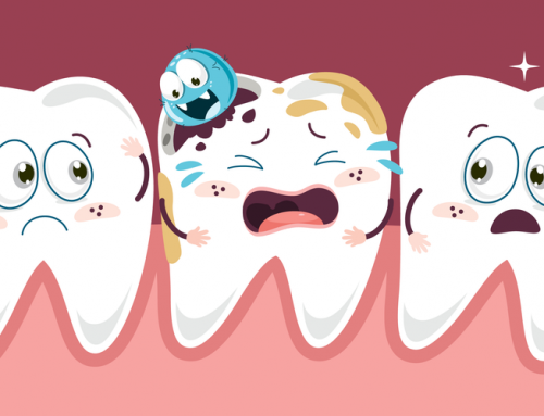 How Tooth Decay Progresses