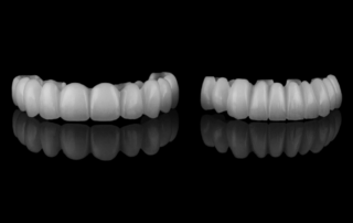 what are temporary dentures