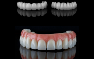 Temporary Dentures vs. Permanent Dentures