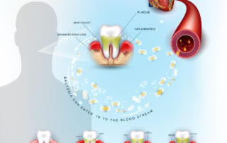 How Gum Disease Affects The Heart