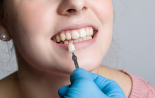 Pros and Cons of Dental Veneers