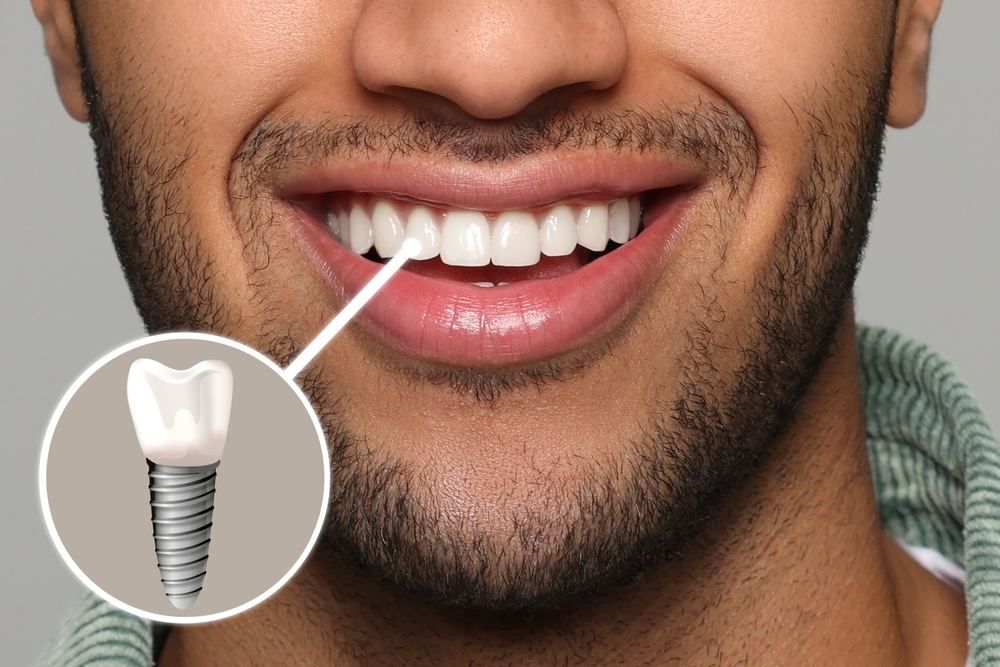 the benefits of cosmetic dentistry