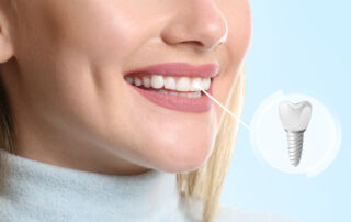 The First Signs You May Need a Dental Implant