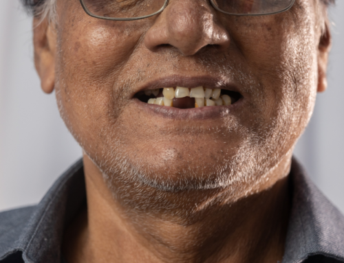 We Can Replace Multiple Teeth in a Single Visit