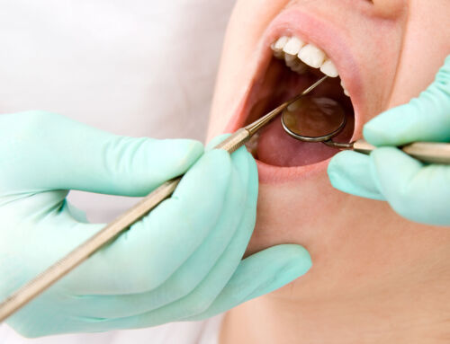 What to Expect at Your First Dental Exam in Keller