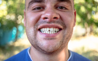 A Simple Fix for Chipped Teeth