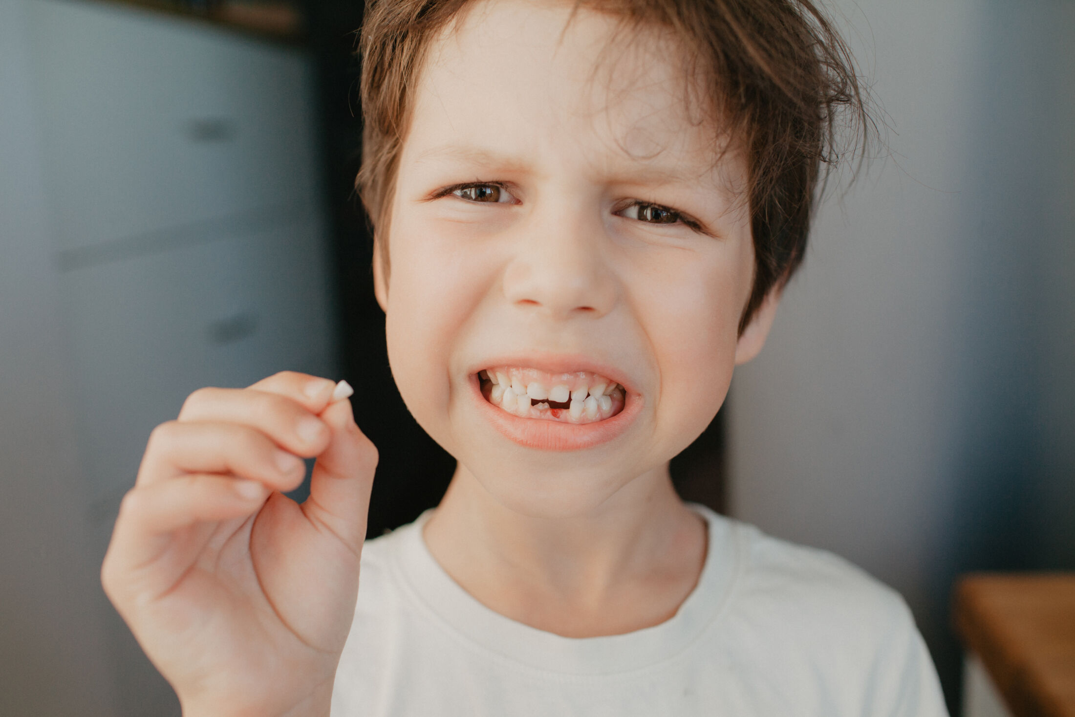 My Son Broke a Tooth at School and I Need an Emergency Dentist