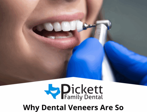 Why Dental Veneers Are So Popular Among Young Adults