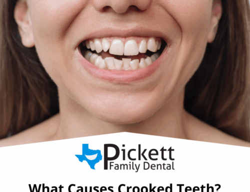 What Causes Crooked Teeth?