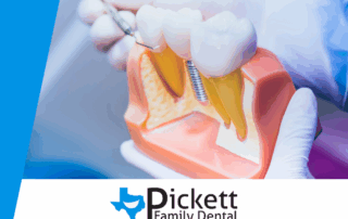 Are Dental Implants Worth It for Missing Teeth