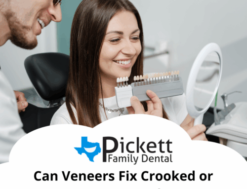 Can Veneers Fix Crooked or Uneven Teeth?