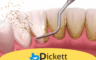 Stop Gum Disease Before It Starts