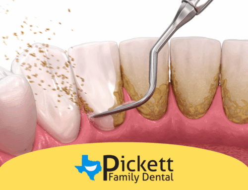 Stop Gum Disease Before It Starts