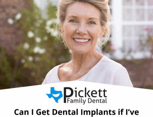 Can I Get Dental Implants if I’ve Had Dentures for Years?