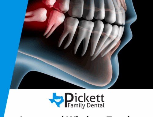 Impacted Wisdom Teeth