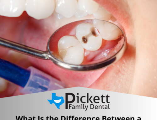 What Is the Difference Between a Cavity and a Root Canal?