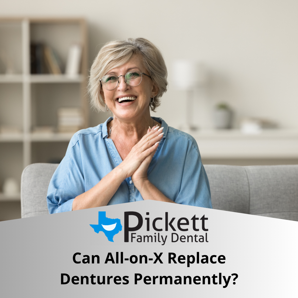 Can All-on-X Replace Dentures Permanently