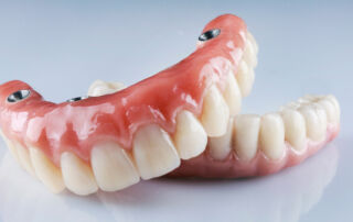 Dentures vs Implants Which Is Better