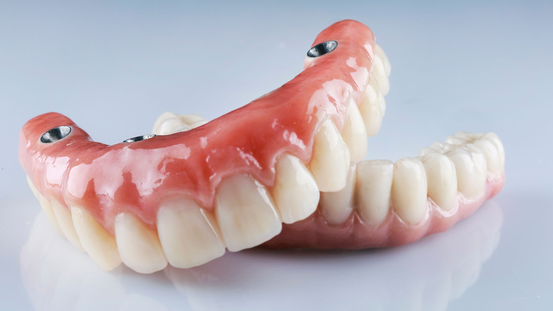 Dentures vs Implants Which Is Better