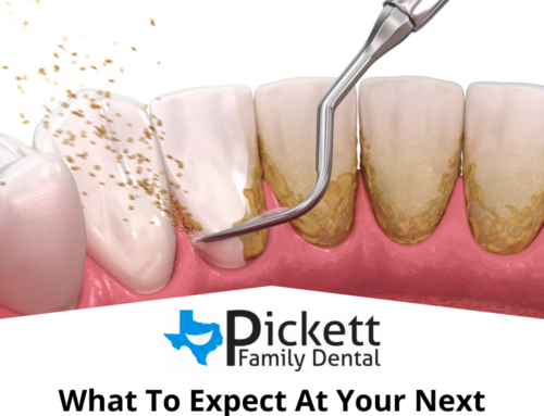 Dental Cleaning Near Me What to Expect