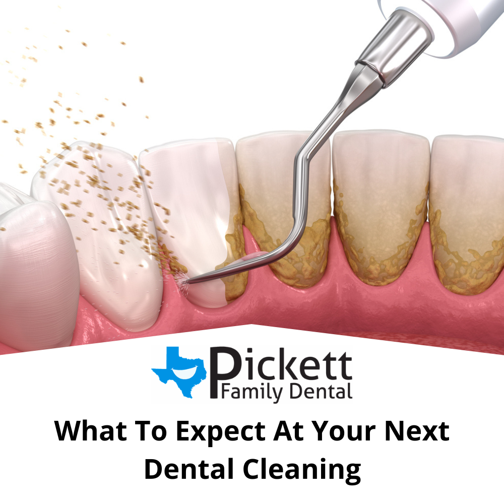 Dental Cleaning Near Me What to Expect