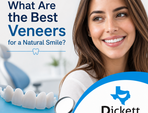 What Are the Best Veneers for a Natural Smile?