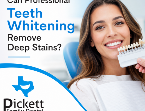 Can Professional Teeth Whitening Remove Deep Stains?