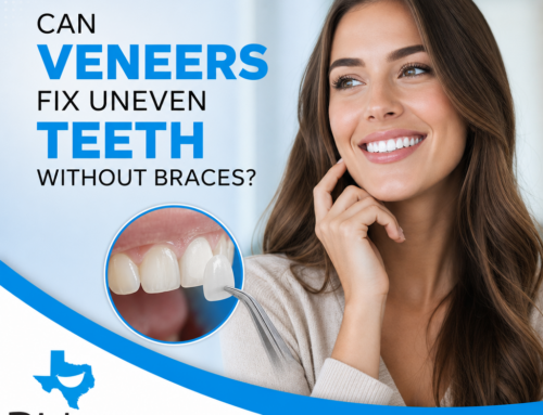 Can Veneers Fix Uneven Teeth Without Braces?
