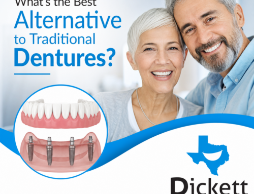 What’s the Best Alternative to Traditional Dentures?